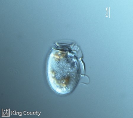 Photo of Dinophysis acuminata